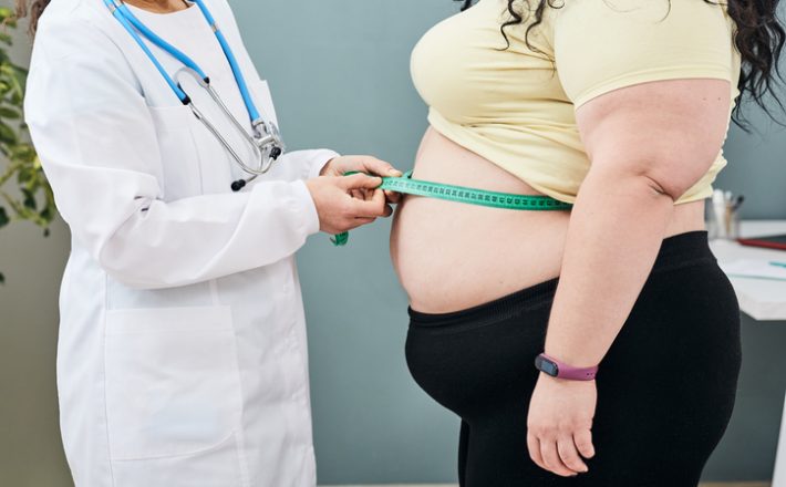 Beneficiário obeso custa R$ 33 mil por ano para a saúde suplementar